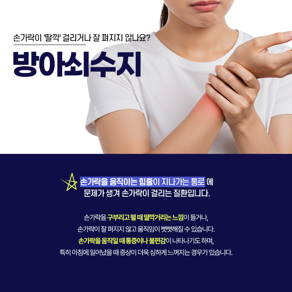 방아쇠수지