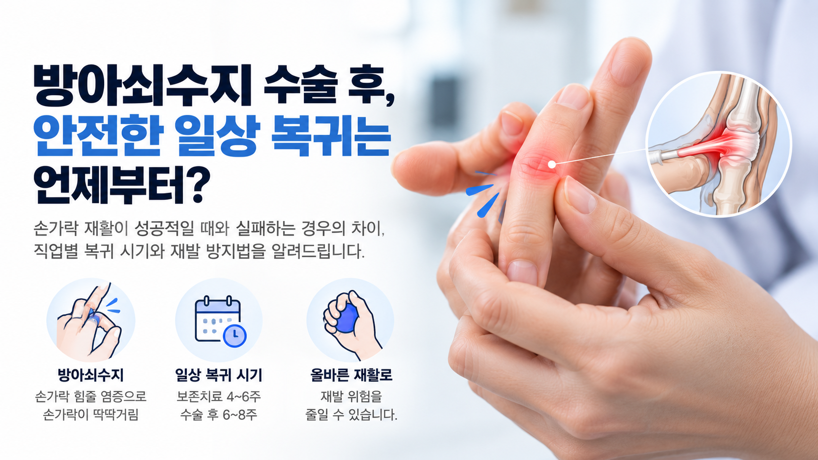 방아쇠수지