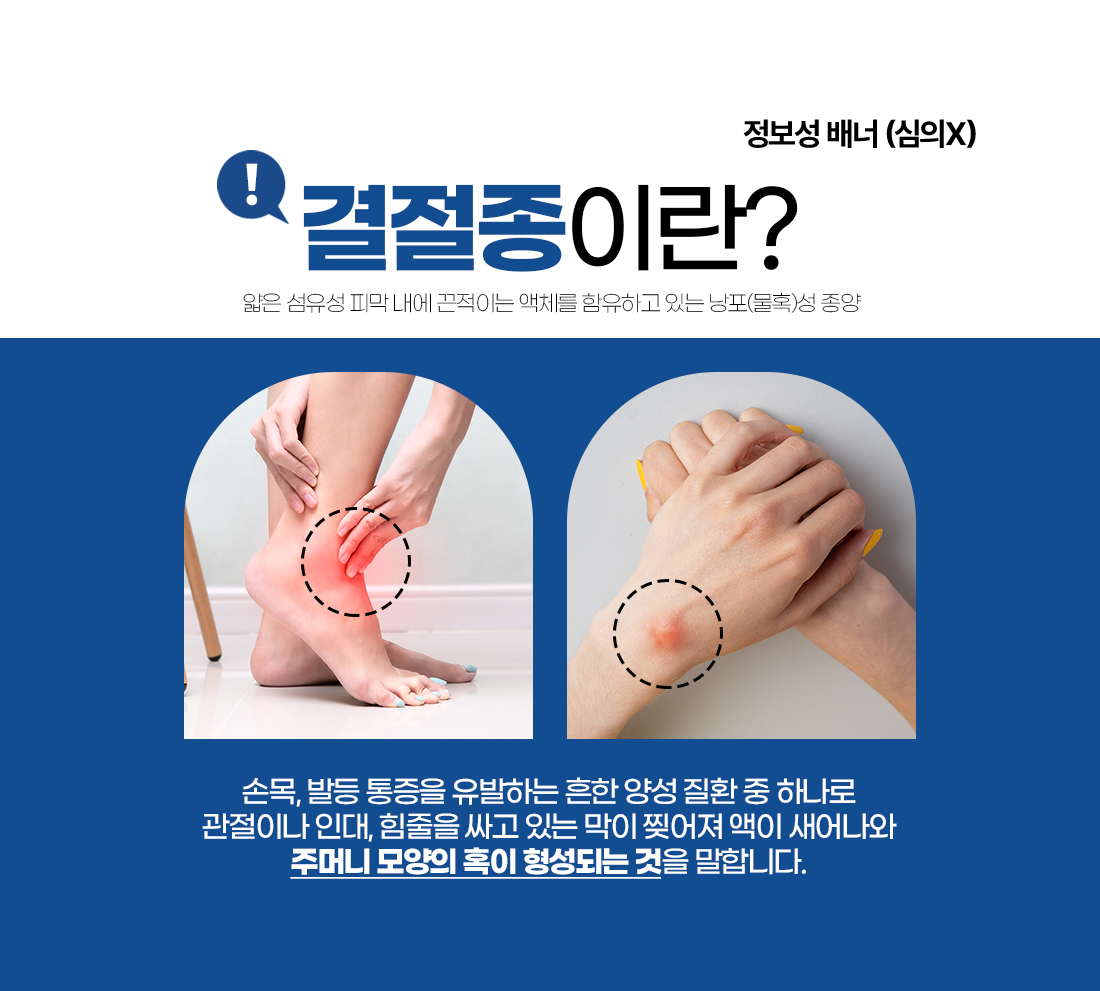 결정종이란