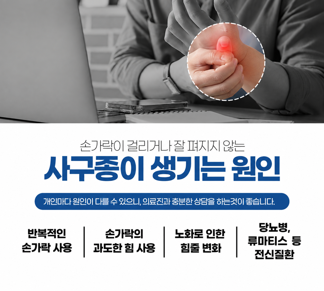 사구종의 원인