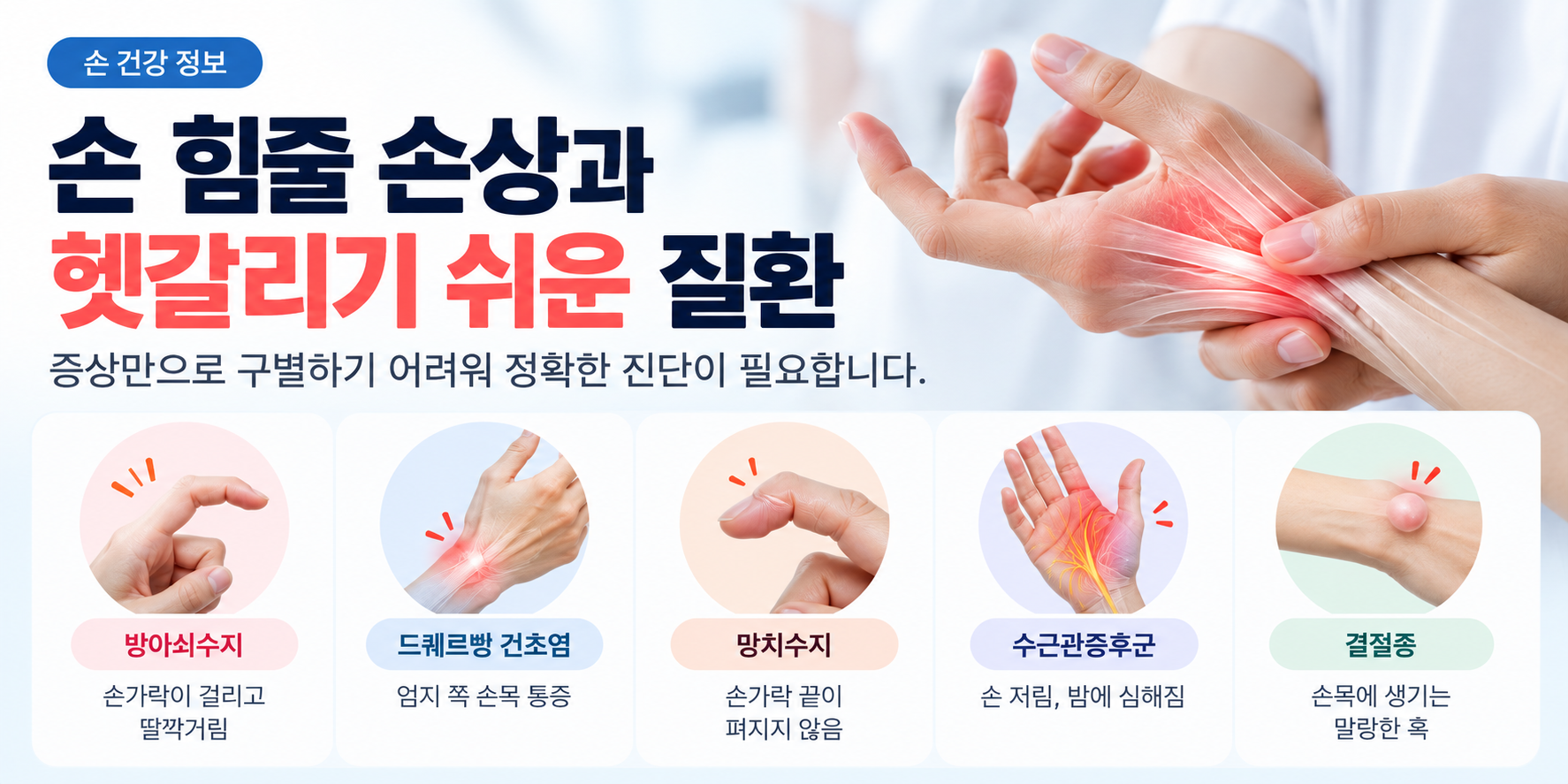 손힘줄손상