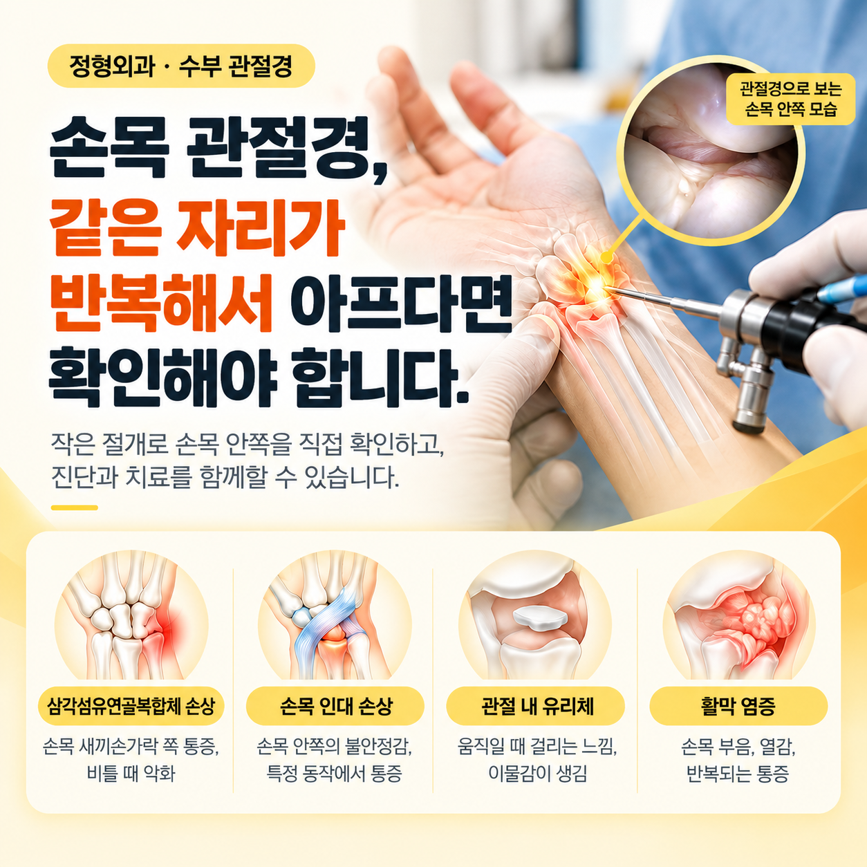 손목관절경